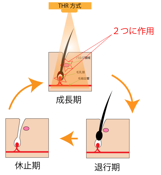 成長期・退行期・休止期の毛周期と、THR方式が作用する場所の図